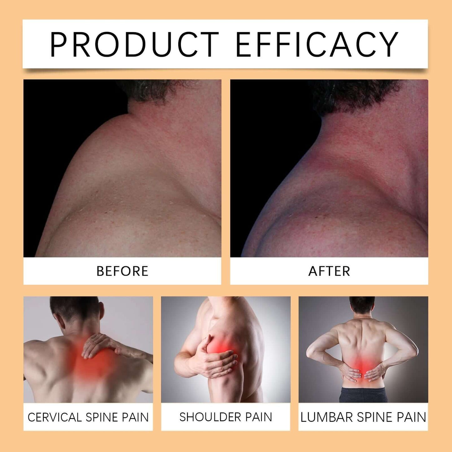 Relieve Back Lumbar Spine Shoulder Joint Body Nursing Adhesive Bandage - Kavirae